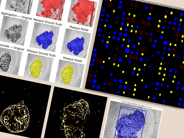 Detection Images with Models IA